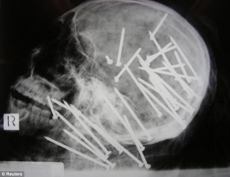 x-ray1.jpg